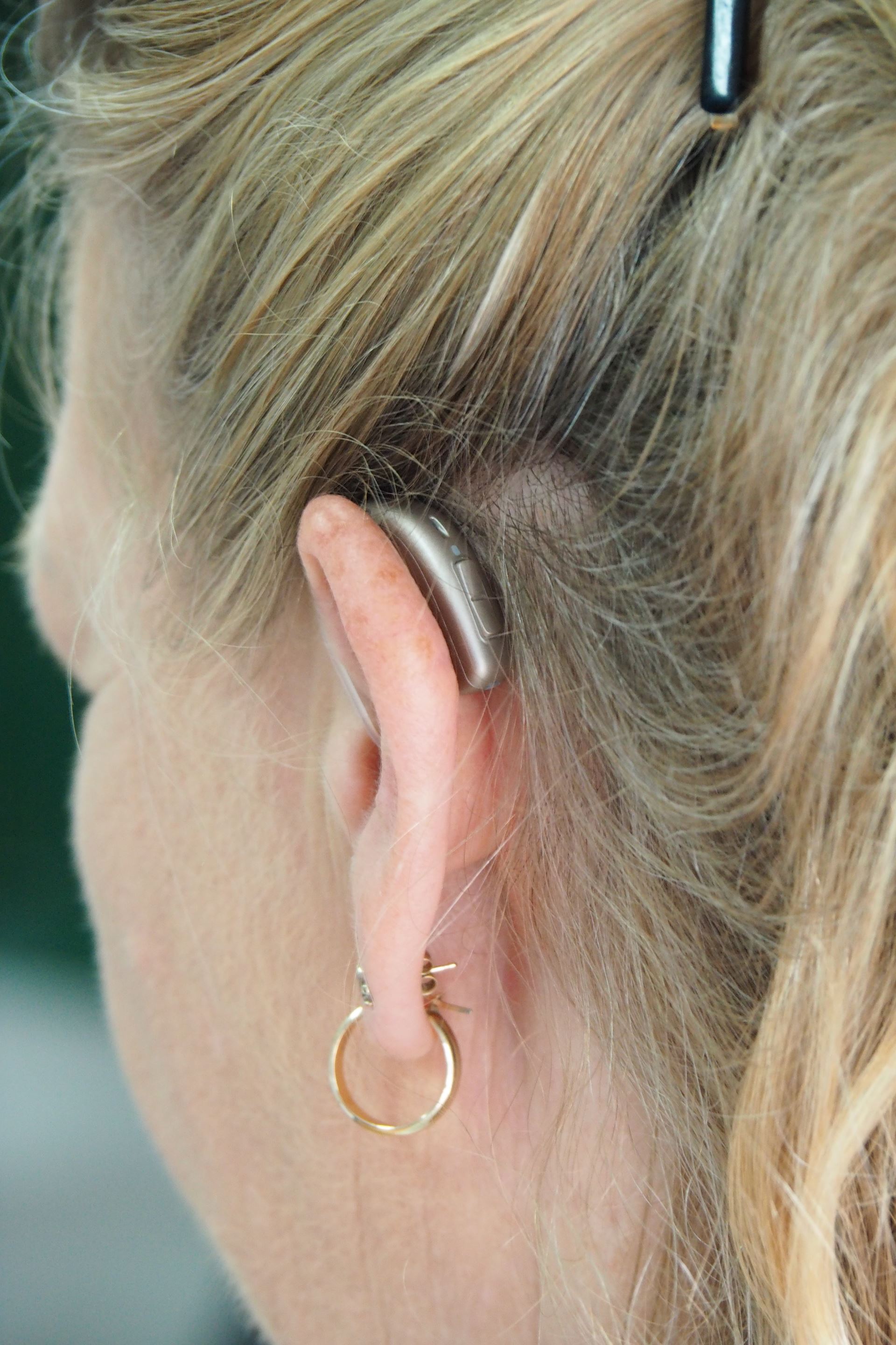 A woman with blonde hair with a hearing aid in the left ear