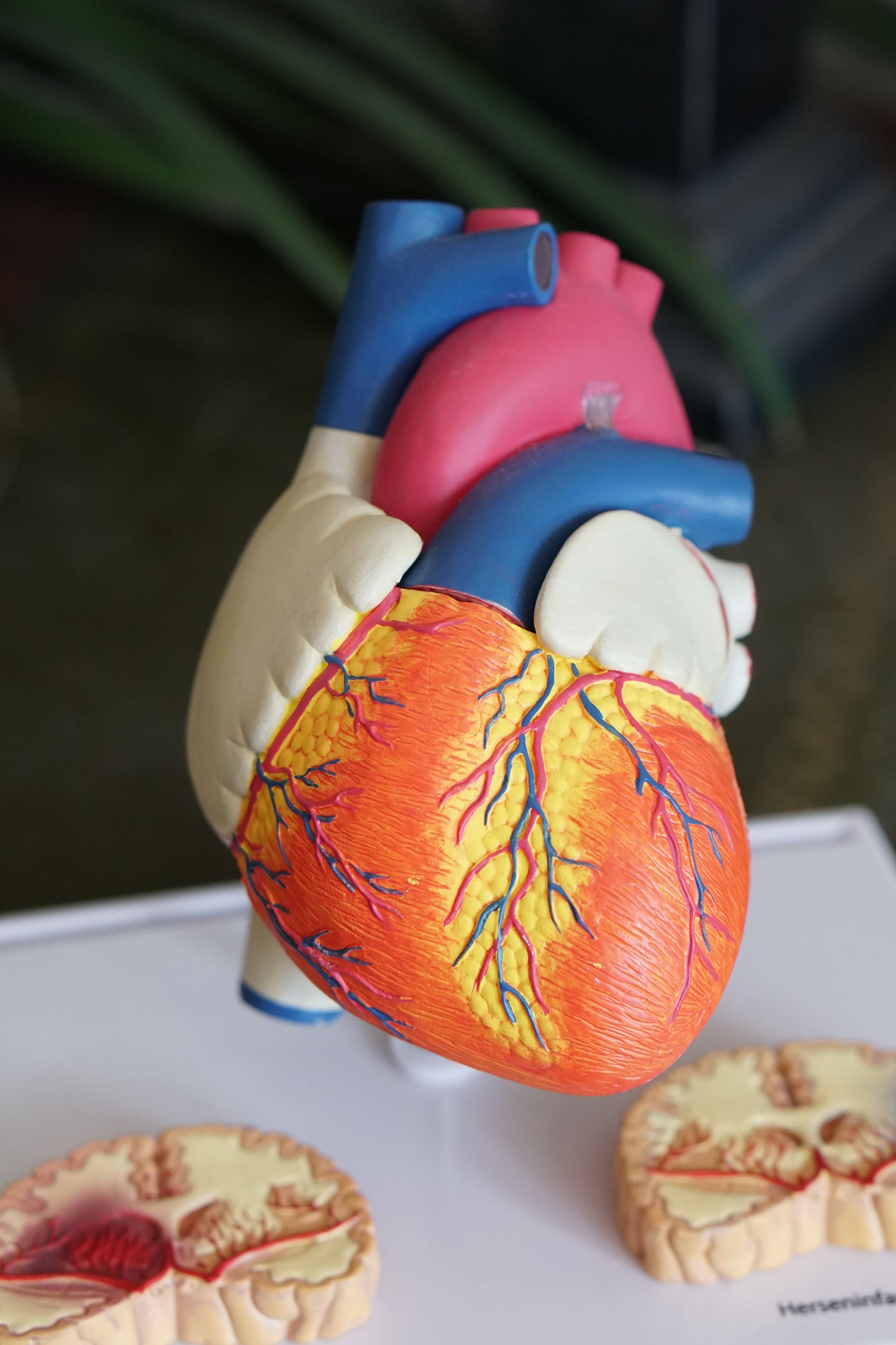a model of a human organ